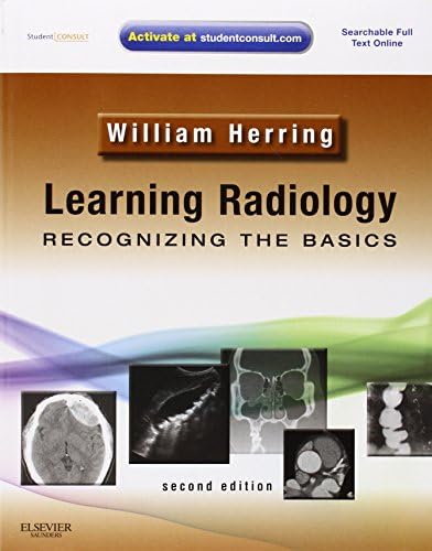 Learning Radiology: Recognizing the Basics [ペーパーバック] Herring MD  FACR，William Amazon.com: Learning Radiology: Recognizing the Basics: William